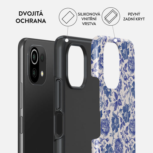 Garden Stories - Xiaomi 11 Lite 5G NE Kryt 2