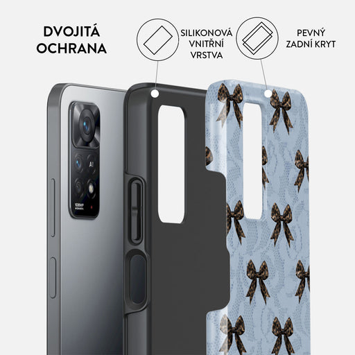 Fashionista - Xiaomi Redmi Note 11 Pro+ Kryt 2