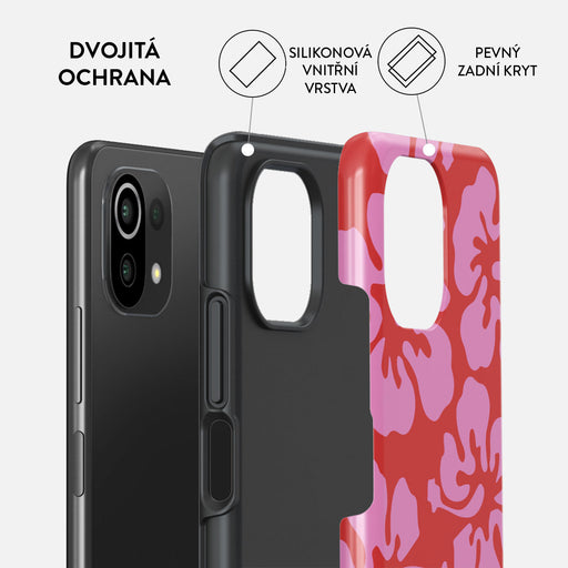 Me Gustas Tu - Xiaomi 11 Lite 5G NE Kryt 2