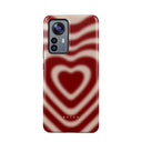 Sweet Affair - Xiaomi 12 Kryt 1
