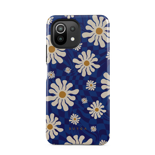 Art Class - Xiaomi Mi 11 Lite 4G / 5G Kryt 1