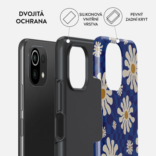 Art Class - Xiaomi Mi 11 Lite 4G / 5G Kryt 2