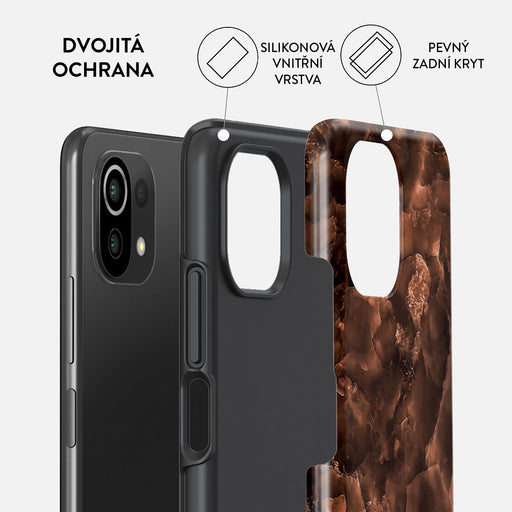 Toasted Chestnut - Xiaomi Mi 11 Lite 4G / 5G Kryt 2