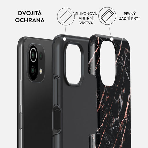 Rose Gold Marble - Xiaomi Mi 11 Lite 4G / 5G Kryt 2